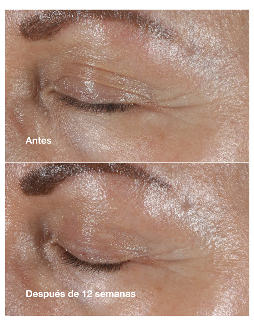CONTORNO DE OJOS SMART CLINICAL REPAIR 30ML - CLINIQUE