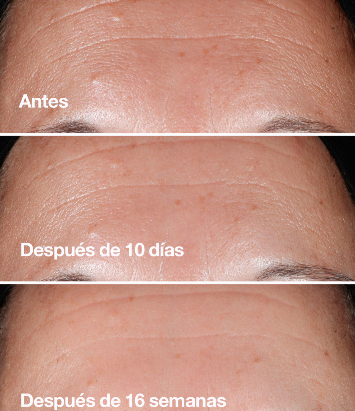 SERUM SMART CLINICAL REPAIR 50 ML - CLINIQUE