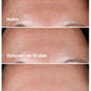 SERUM SMART CLINICAL REPAIR 30 ML - CLINIQUE