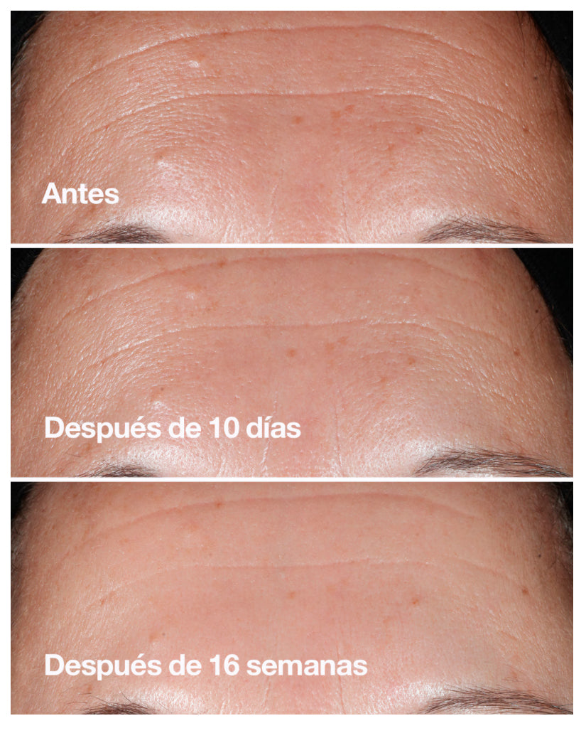SERUM SMART CLINICAL REPAIR 30 ML - CLINIQUE