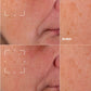 SERUM EVEN BETTER CLINICAL 50ML - CLINIQUE