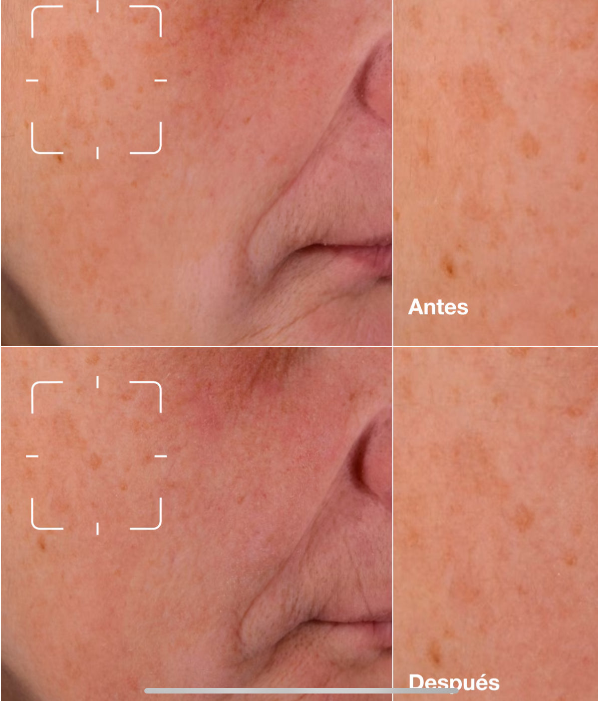 SERUM EVEN BETTER CLINICAL 50ML - CLINIQUE