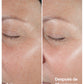 SERUM SMART CLINICAL REPAIR 30 ML - CLINIQUE
