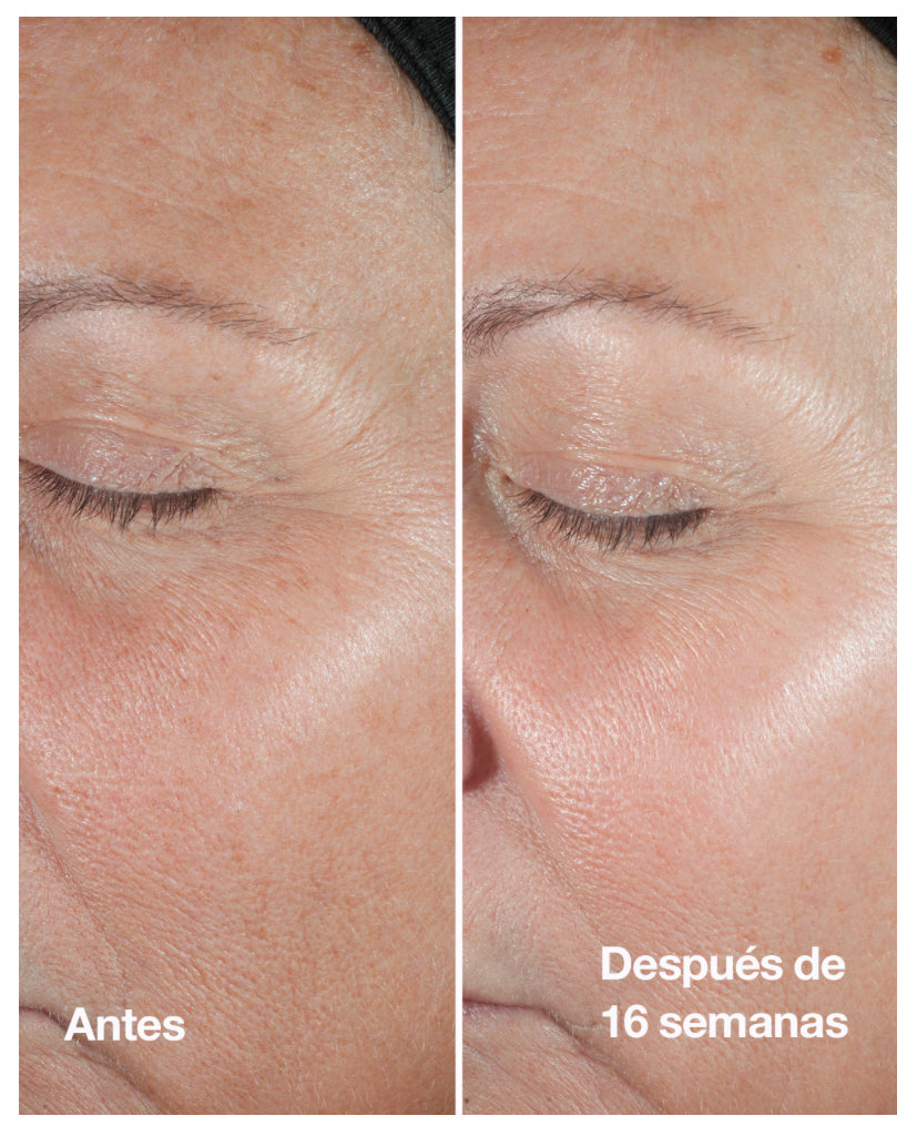 SERUM SMART CLINICAL REPAIR 30 ML - CLINIQUE