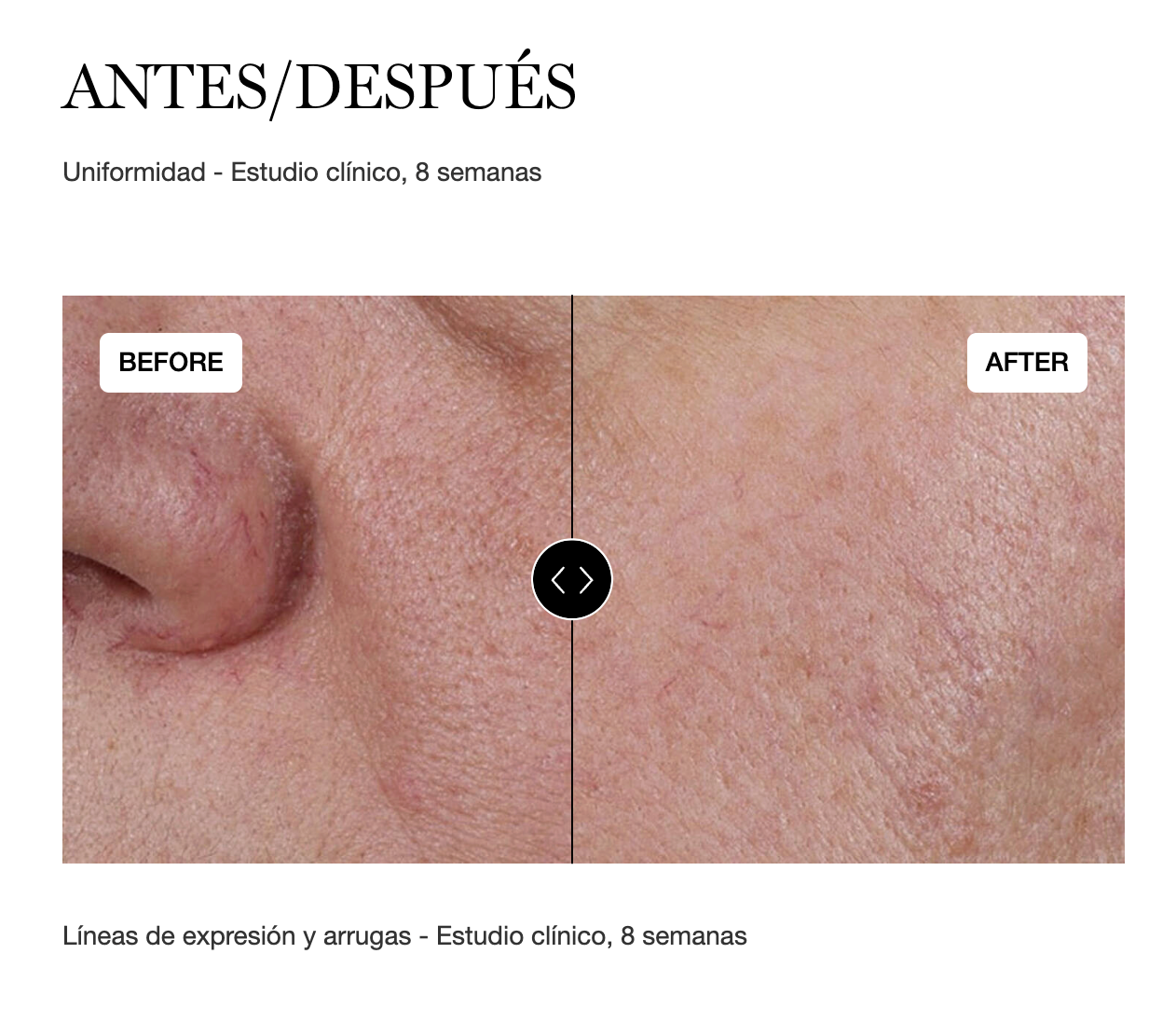 SERUM GENIFIQUE 30ML - LANCOME