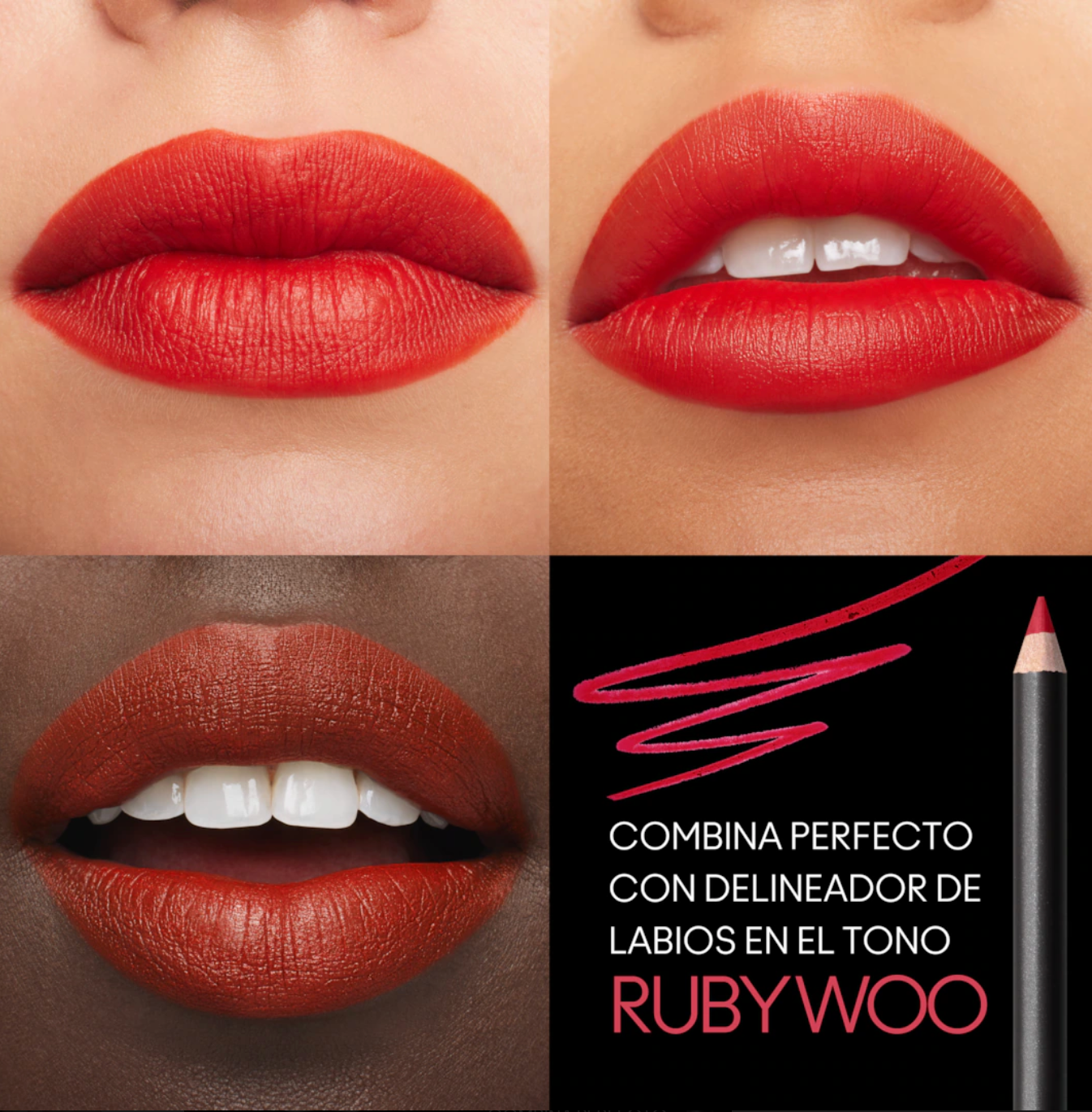 LABIAL M.A.CXIMAL OVERSTATEMENT - MAC