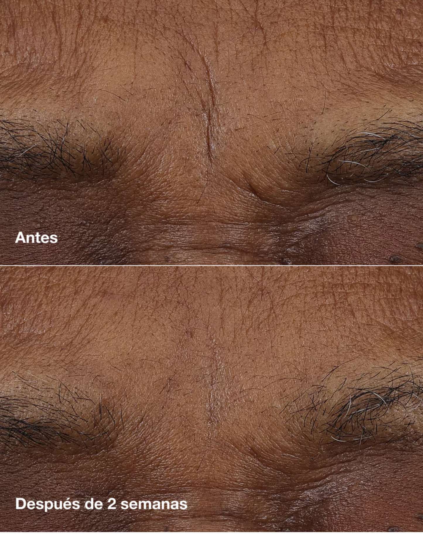 BALSAMO DE RETINOL - CLINIQUE
