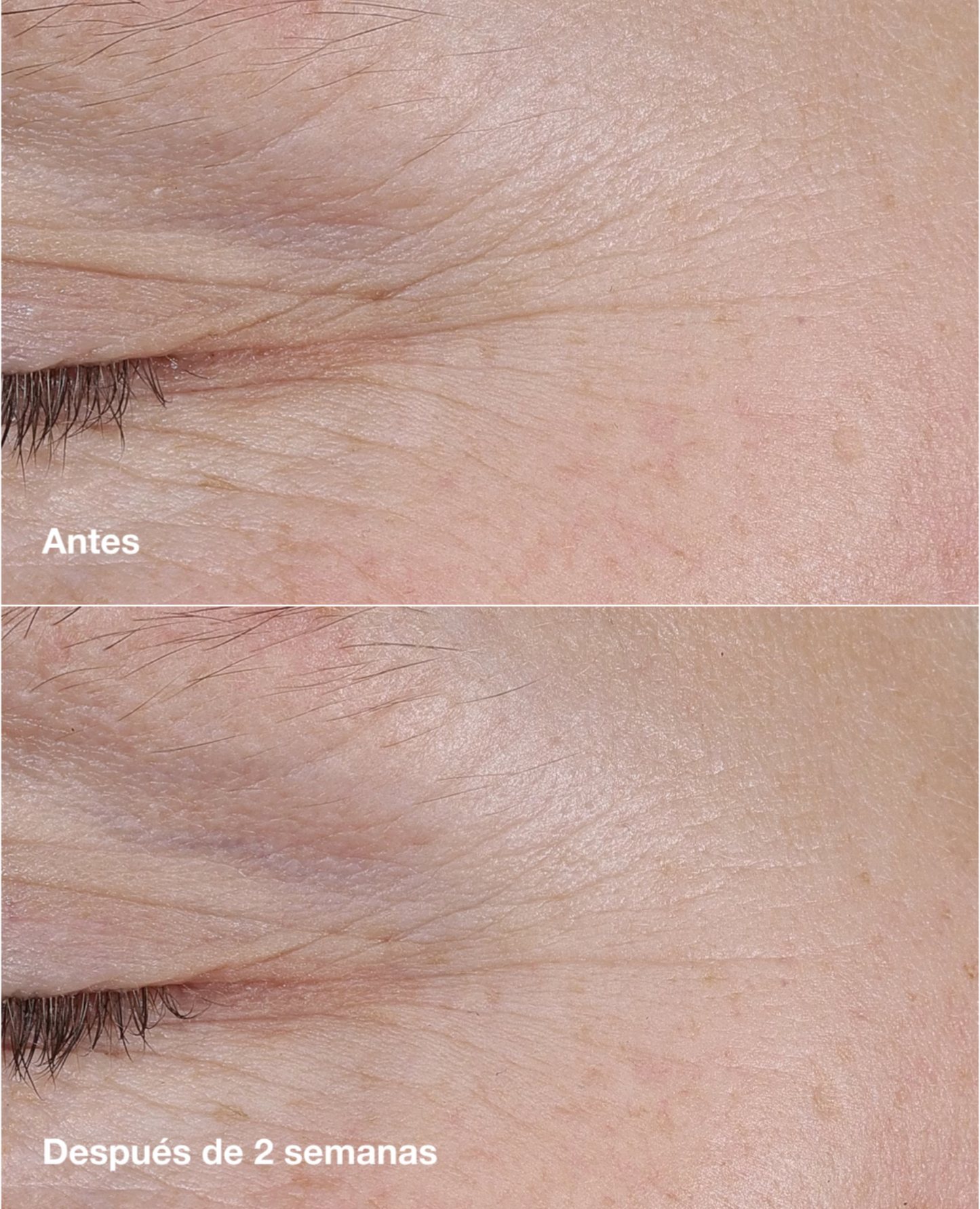 BALSAMO DE RETINOL - CLINIQUE